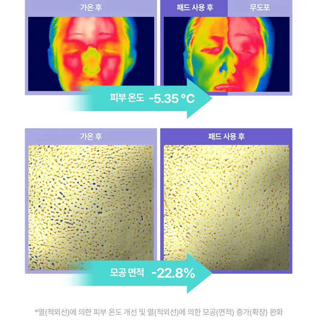 [5월 올영픽/126매 대용량/올리브영 단독] 리쥬란 포어 타이트닝 토너 패드 60매 더블 한정 기획 상세페이지 27